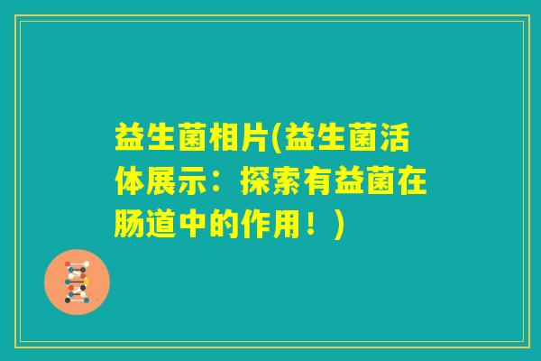 益生菌相片(益生菌活体展示：探索有益菌在肠道中的作用！)